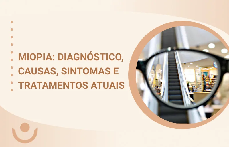 Miopia Diagnóstico, Causas, Sintomas e Tratamentos Atuais COB Oftalmologia