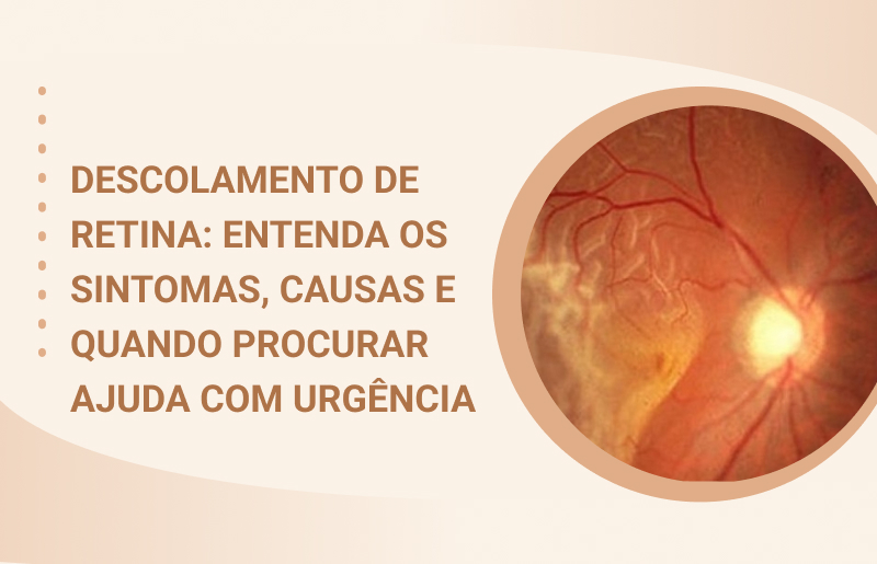 descolamento de retina cob oftalmologia